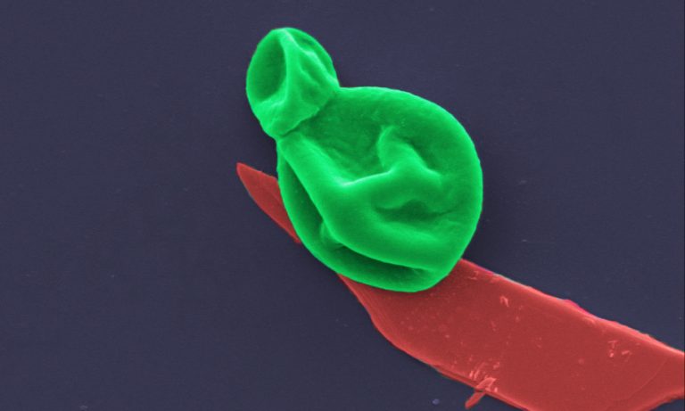 Разрушенные микробные клетки под микроскопом