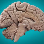 Человеческий мозг в разрезе