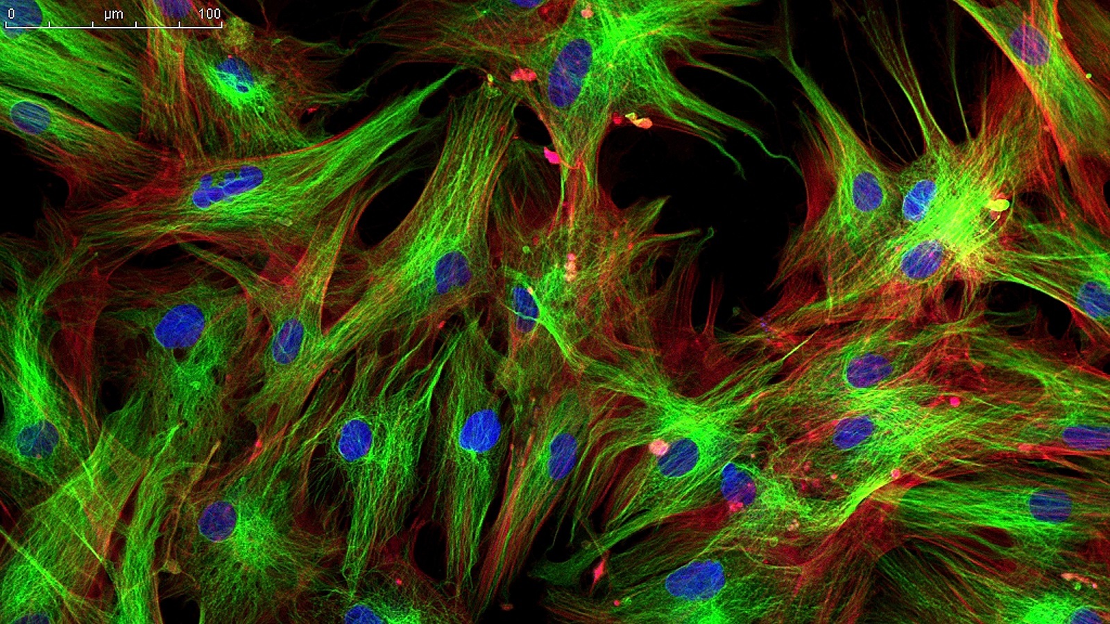 Создан новый метод отслеживания клеток при помощи флуоресцентных «микрометок»