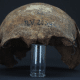В черепе умершего 5000 лет назад человека нашли древнейший образец чумной палочки