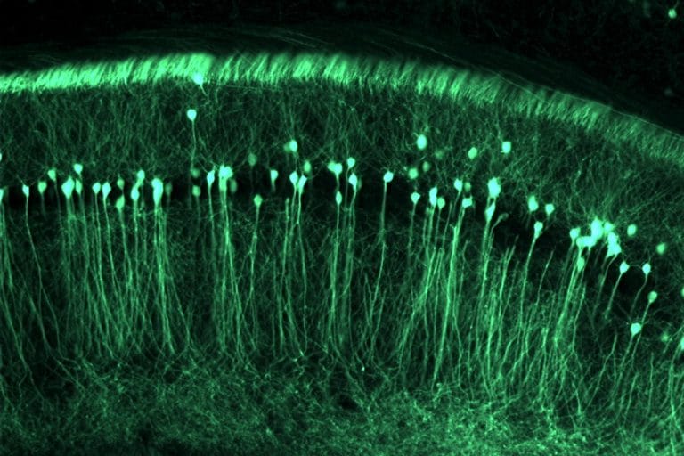 Нейроны гиппокампа в головном мозге мыши