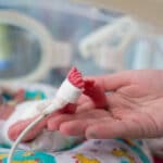Разработка пермских ученых поможет улучшить лечение недоношенных детей