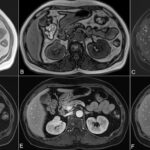 Рентгеноконтрастные гелевые агенты помогут точнее определять патологии органов