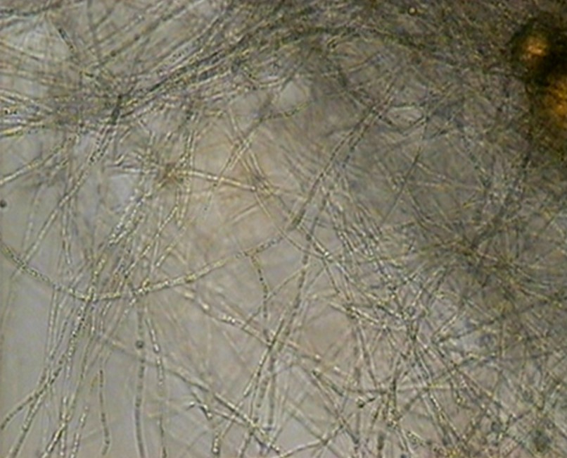 Микроорганизмы, которые использовали для получения биосорбента (суспензия штамма Streptomyces Alboaxialic «С») / ©Пресс-служба ПНИПУ