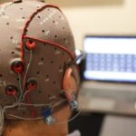 Реабилитацию детей с артрогрипозом сможет облегчить стимуляция мозга