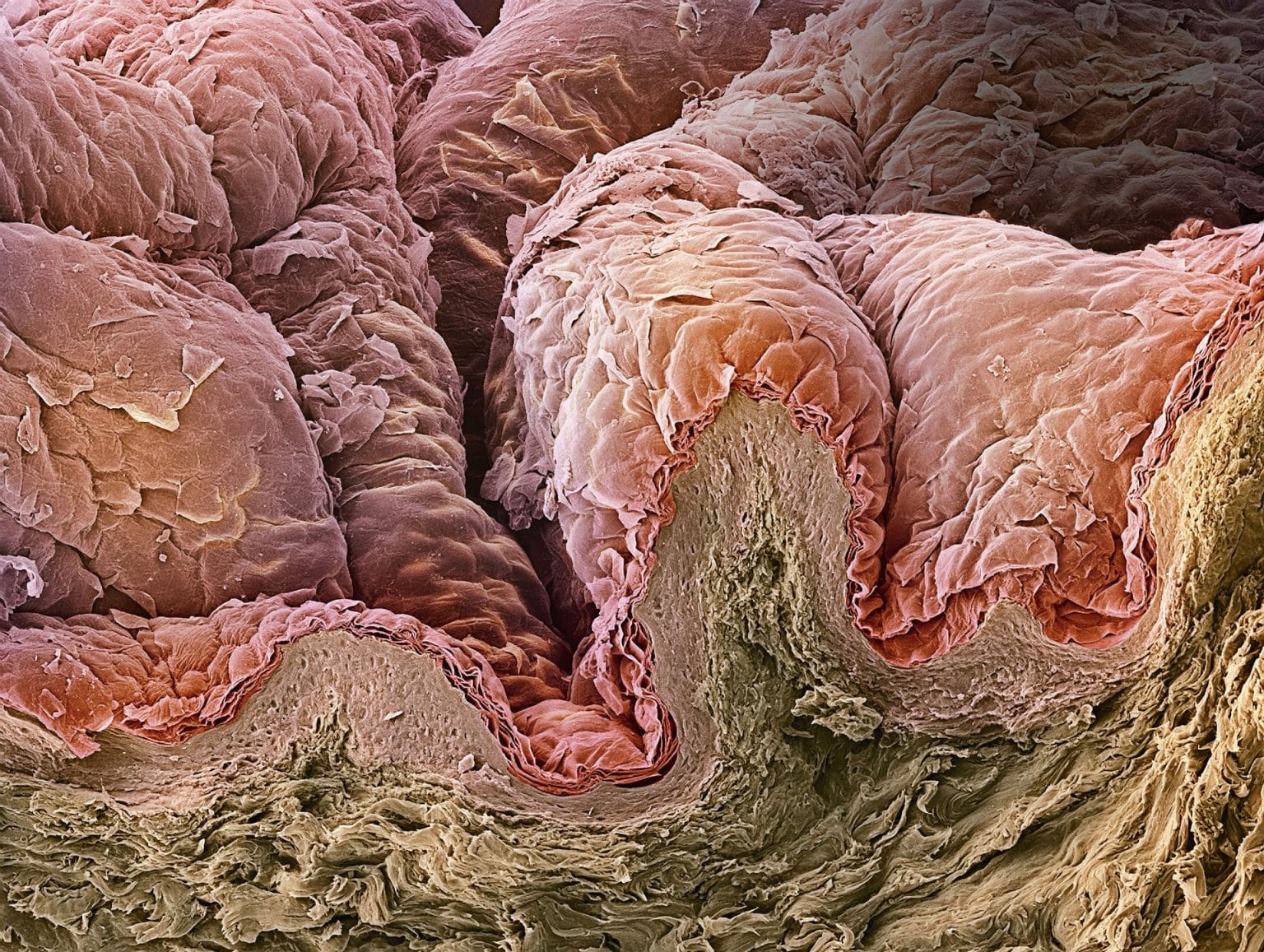 Роговой слой эпидермиса под микроскопом