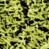 Микрофотография бактерий рода Clostridium.