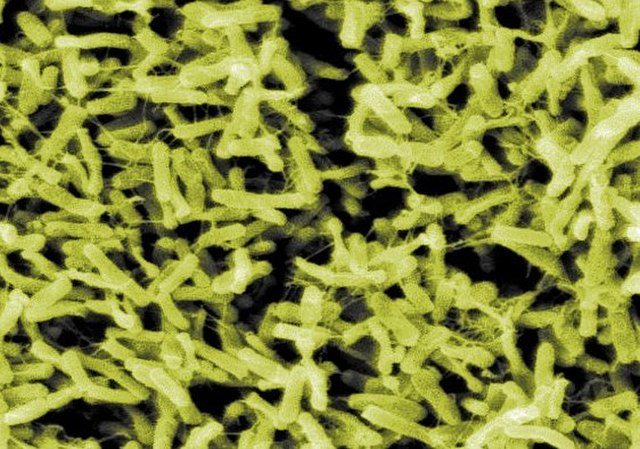 Микрофотография бактерий рода Clostridium.