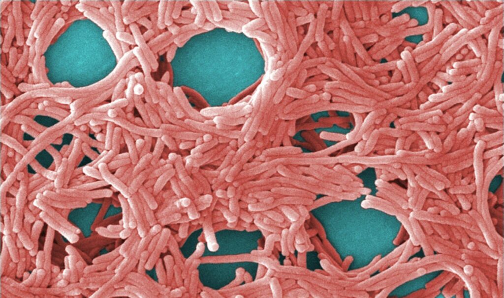 Legionella pneumophila