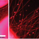 Разветвленная сеть нейритов, сформированная между 3 имплантатами за 72 часа. Масштаб линейки на левом изображении – 50 мкм, на правом – 500 мкм.