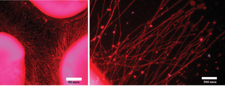Разветвленная сеть нейритов, сформированная между 3 имплантатами за 72 часа. Масштаб линейки на левом изображении – 50 мкм, на правом – 500 мкм.