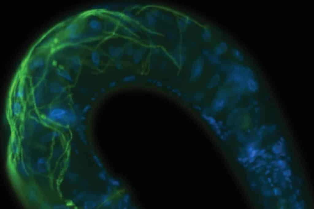 Нити Bordetella atropi в кишечнике нематоды