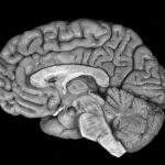 По активности мозга ученые смогли различить воображаемую и реальную картину, которую видит человек