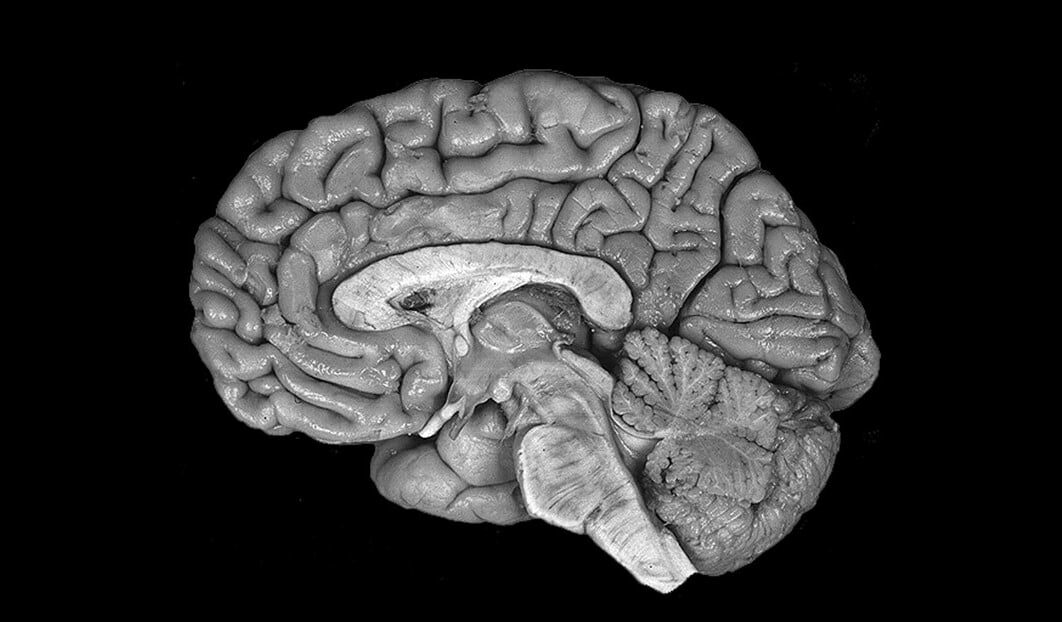 По активности мозга ученые смогли различить воображаемую и реальную картину, которую видит человек