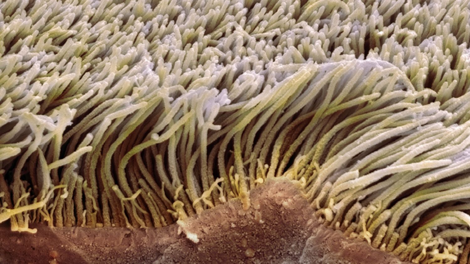 Эпителиальные клетки с ресничками