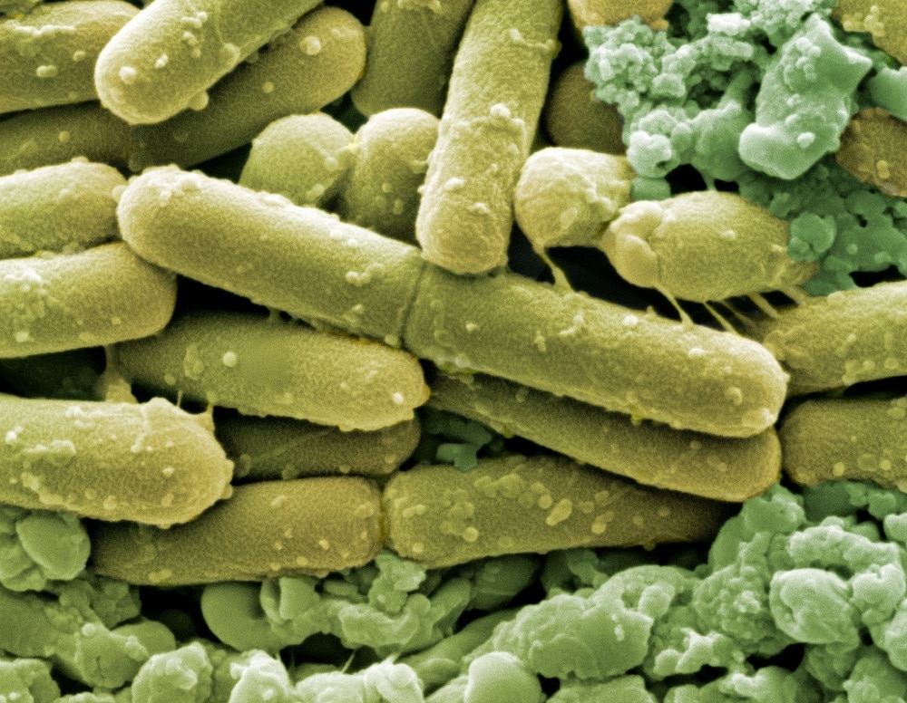 Патогенная бактерия Clostridiodes difficile