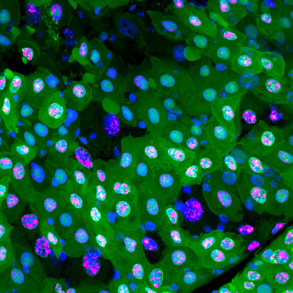 Во время эребоза клетки теряют флуоресцентные белки