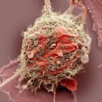 Ученые выявили виновников рецидивов у больных раком легких