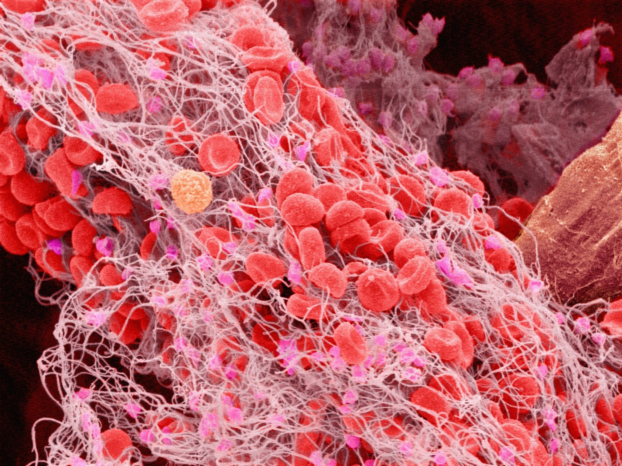 Как выглядит тромбоцит под микроскопом фото