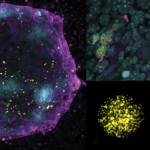 Исследование инактивации Х-хромосомы открывает путь к созданию искусственных яйцеклеток