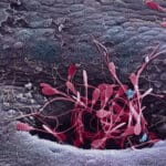 Установлен механизм нарушения сперматогенеза при нагревании