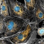 На микрофотографии тканей млекопитающего митохондрии окрашены желтым, клеточные ядра — голубым, цитоскелет — серым
