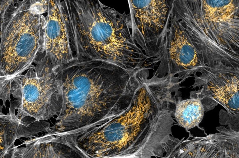 На микрофотографии тканей млекопитающего митохондрии окрашены желтым, клеточные ядра — голубым, цитоскелет — серым