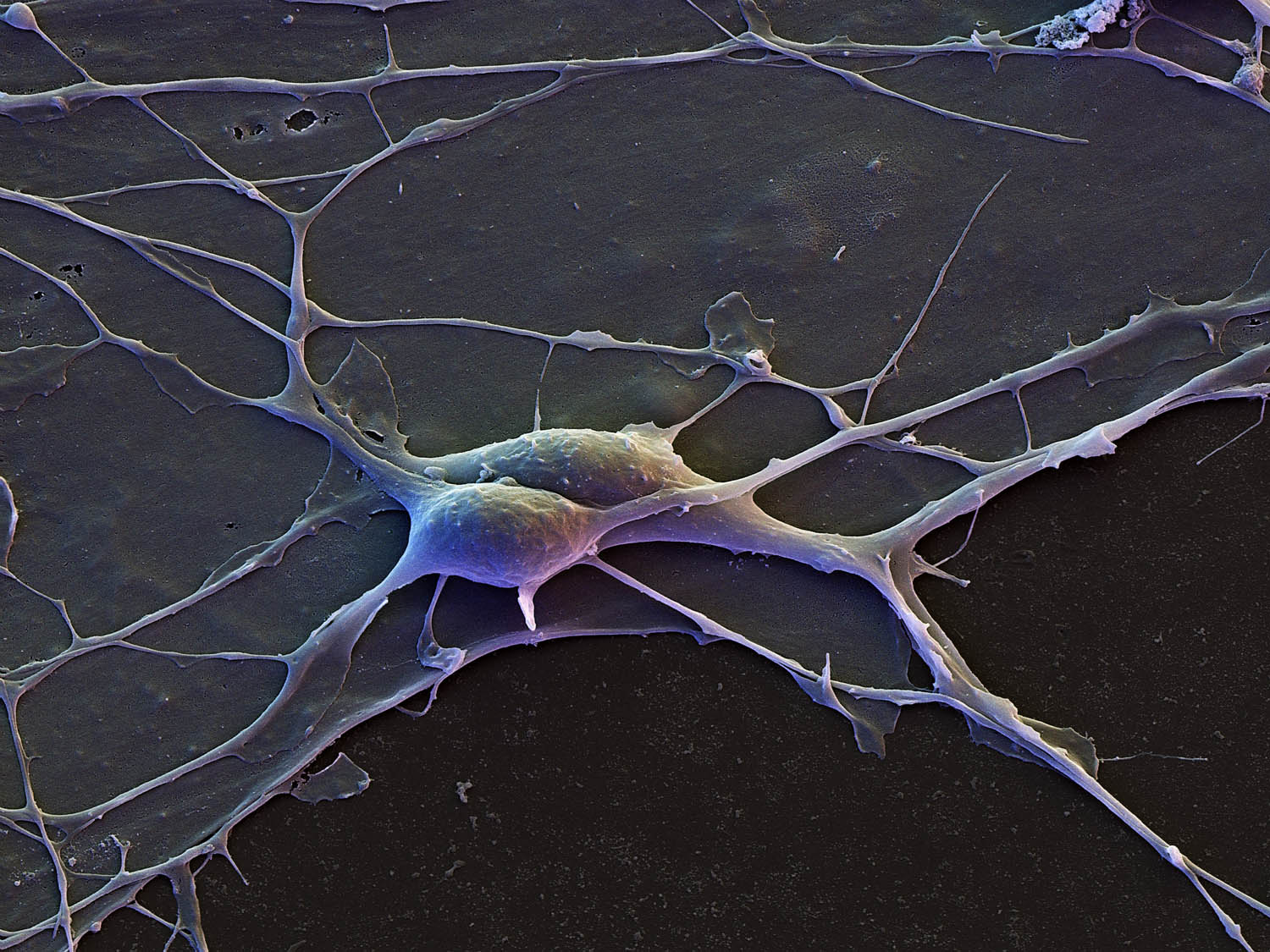 Нейроны коры больший полушарий
