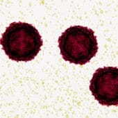 Полиомиелит