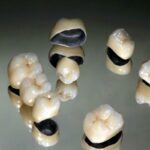 В ЛЭТИ узнали, как усовершенствовать зубные протезы