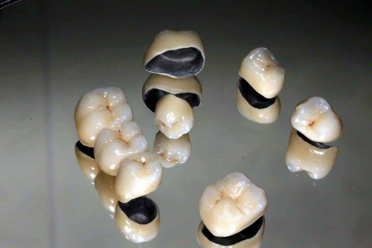 В ЛЭТИ узнали, как усовершенствовать зубные протезы