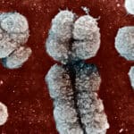 Потеря Y-хромосомы грозит мужчинам преждевременной смертью из-за сердечной недостаточности