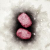 Снимок вируса оспы обезьян
