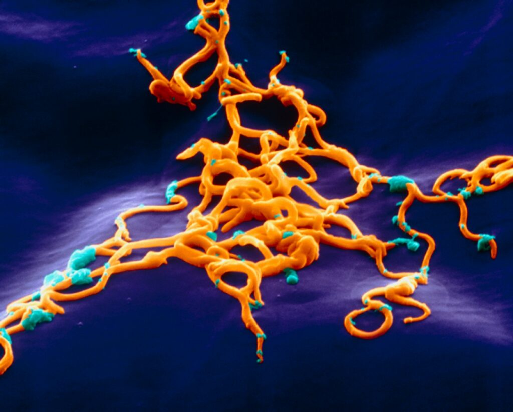 Borrelia burgdorferi, возбудитель болезни Лайма