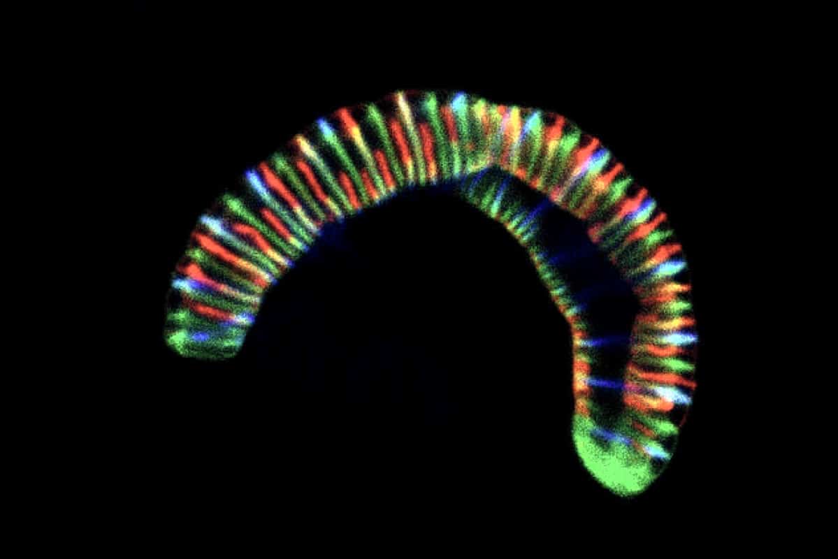 Conchiformibius steedae: флуоресцентная микрофотография
