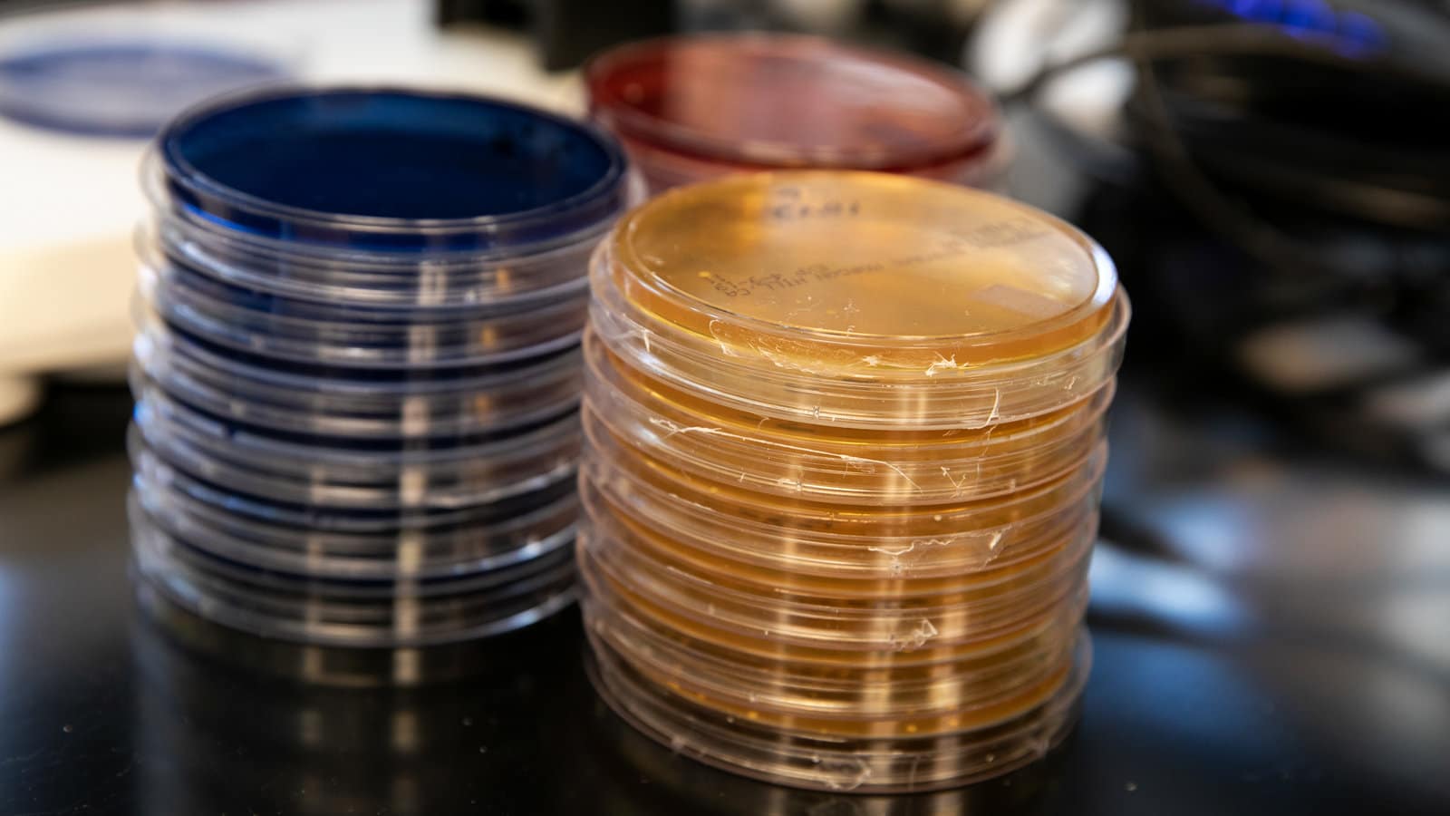 Чашки Петри с бактериями, используемыми для фекальной трансплантации