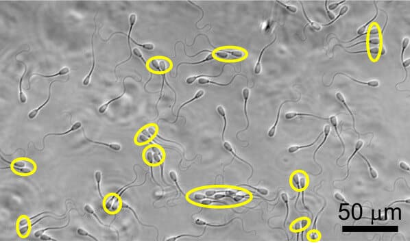 Сперматозоиды поодиночке и группами (в желтых кружках) S Phuyal, SS Suarez, C-K Tun