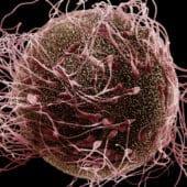 Сперматозоиды и яйцеклетка под сканирующим электронным микроскопом