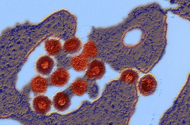 Частицы HERV-K – ретровируса, способного встраиваться в геном человека