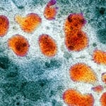 Вирус птичьего гриппа понизил уровень тестостерона у мужчин
