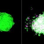 Ученые показали, как бактерии помогают опухоли преодолевать иммунную защиту и метастазировать