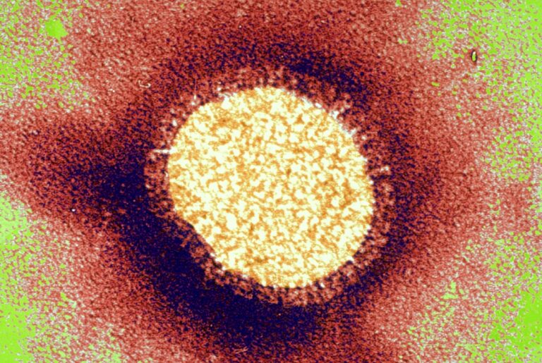 Вирус гриппа под электронным микроскопом
