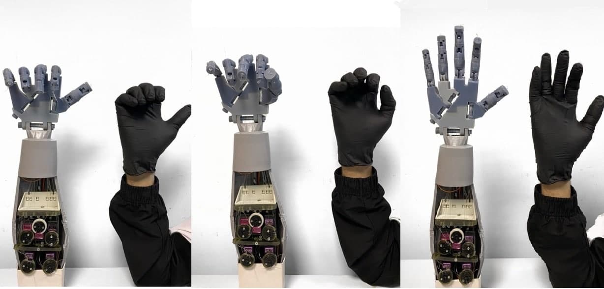 В ЛЭТИ разработали «умную» перчатку для проведения высокоточных медицинских операций