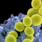 Антибиотики последнего резерва заставляют бактерии «каменеть»