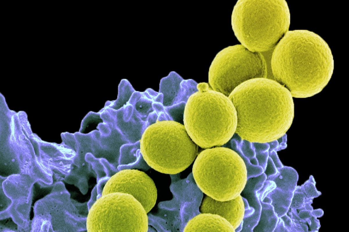 Антибиотики последнего резерва заставляют бактерии «каменеть»