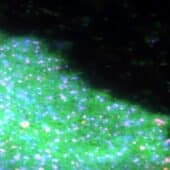 Биопленка Caulobacter под микроскопом: живые клетки помечены зеленым, мертвые — розовым, внеклеточная ДНК — синим флуоресцентным белком