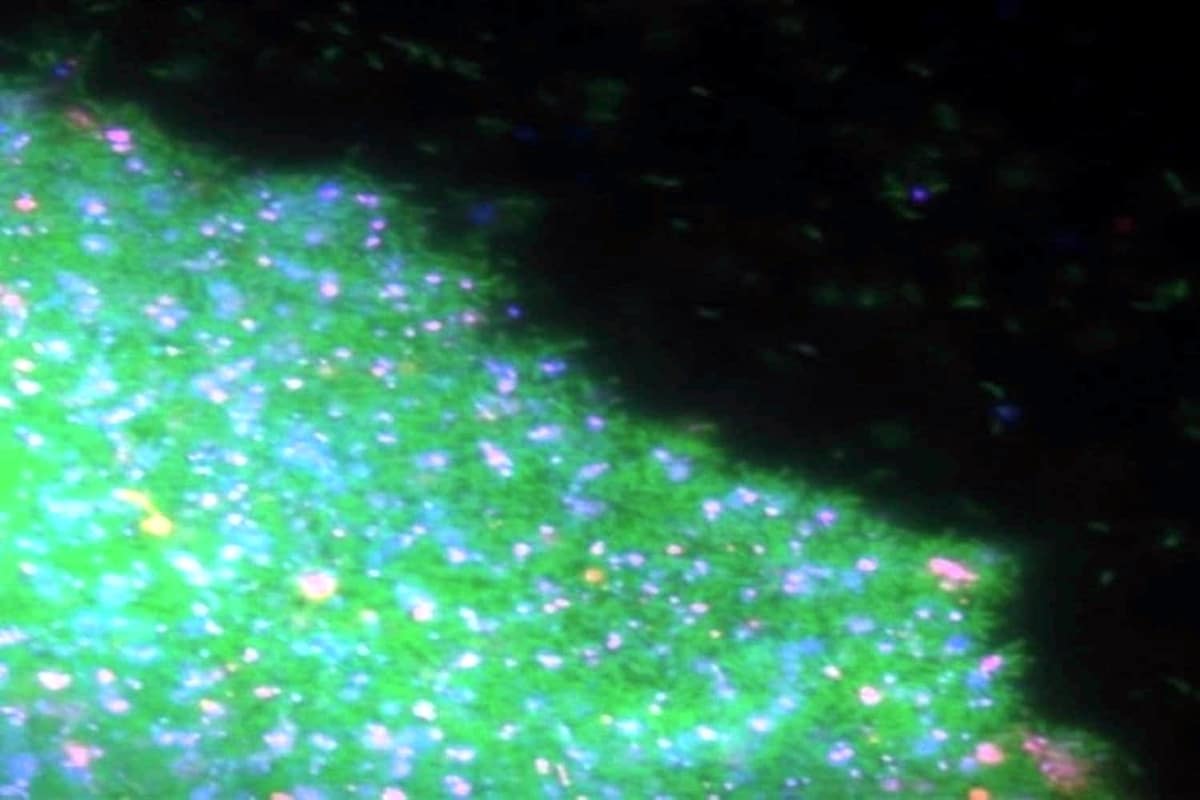 Биопленка Caulobacter под микроскопом: живые клетки помечены зеленым, мертвые — розовым, внеклеточная ДНК — синим флуоресцентным белком