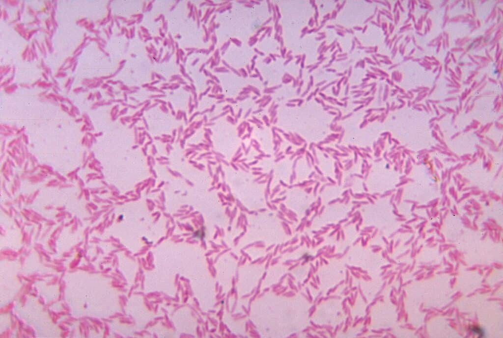 Бактерии рода Bacteroides позволяют организму получать максимум питательных веществ, создавая условия для развития ожирения