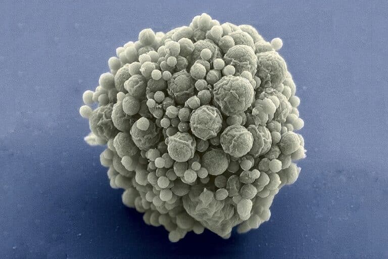 Клетки Syn 3.0 под микроскопом