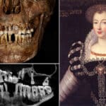 Ученые раскрыли секрет стоматологов XVII века